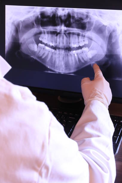 Best Cracked Tooth Emergency Dentist  in Kasson, MN