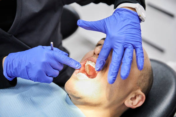 Best Dentist for Tooth Abscess  in Kasson, MN